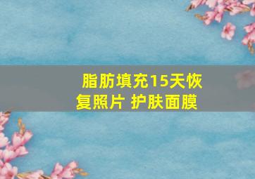 脂肪填充15天恢复照片 护肤面膜